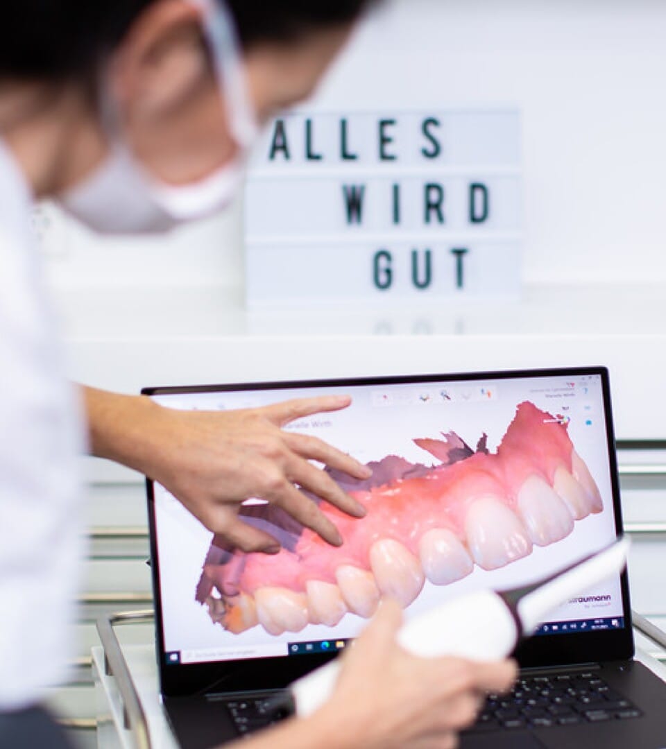 Aligner